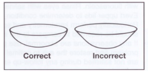edges contact lens test